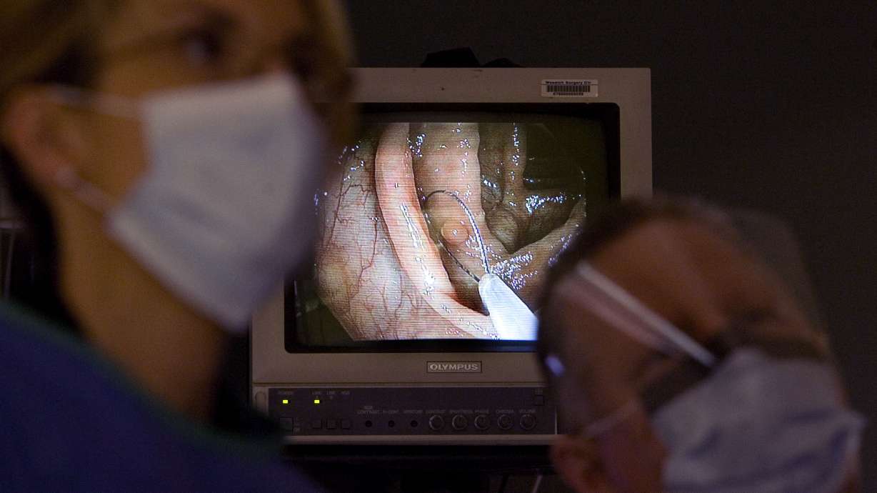 Los médicos de Utah dicen que la falta de colonoscopia durante la pandemia ha provocado un aumento del cáncer